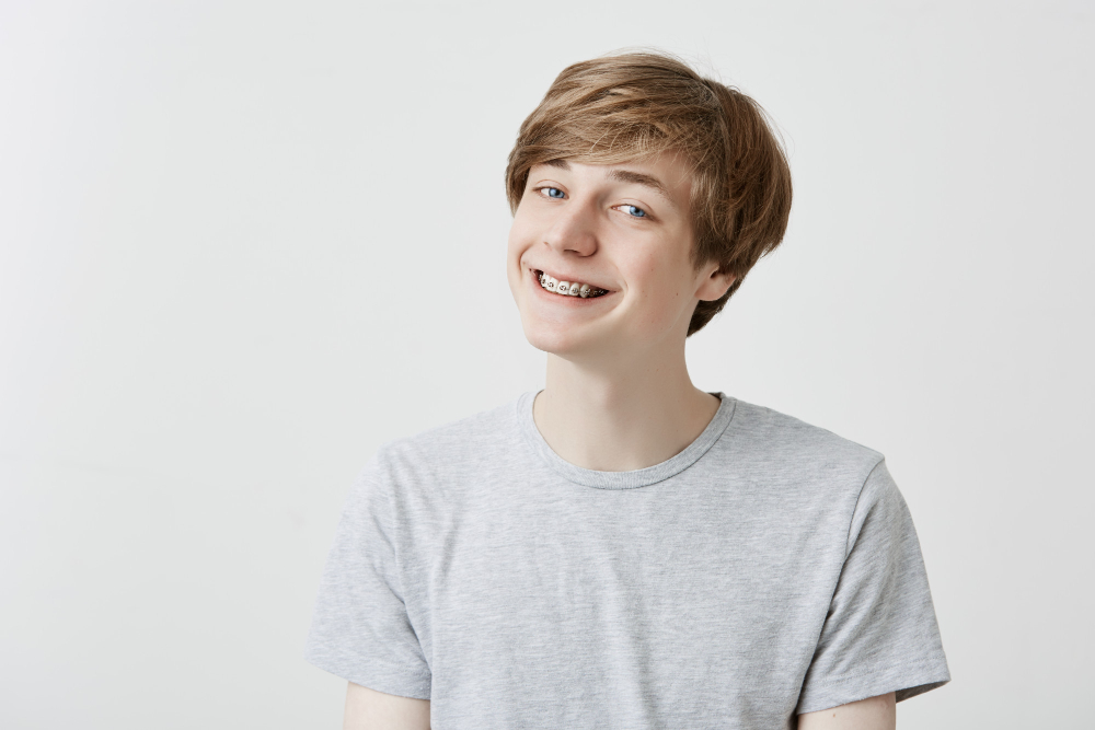 INVISALIGN® VS. BRACES: COMMONLY ASKED QUESTIONS