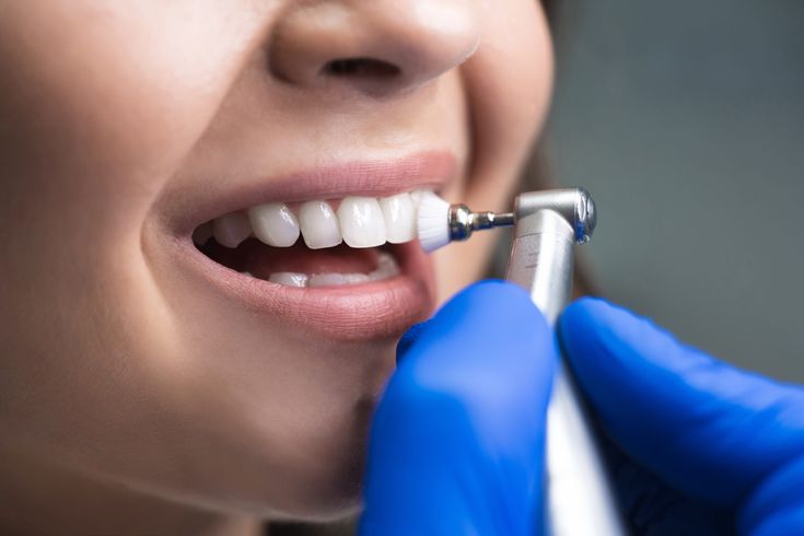 Why Regular Teeth Cleaning Is Essential for Long-Term Oral Health