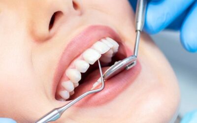 Meet the Best Cosmetic Dentist in Tampa for Your Smile Makeover