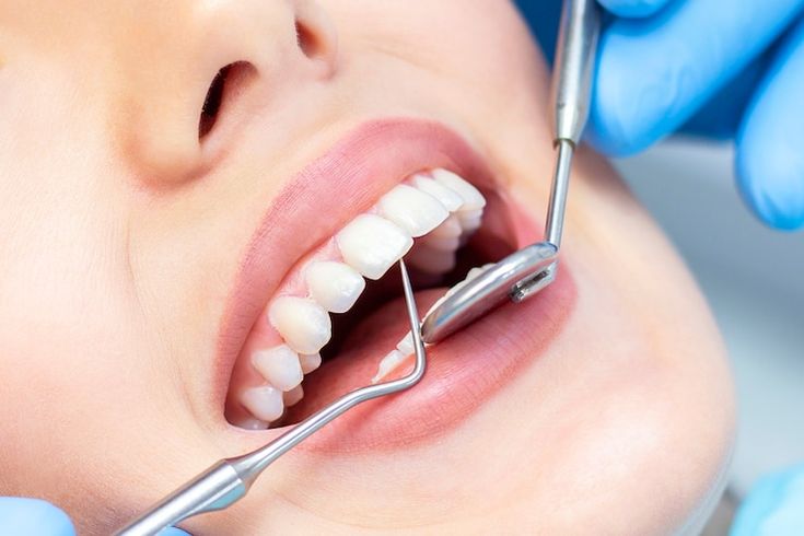 Meet the Best Cosmetic Dentist in Tampa for Your Smile Makeover