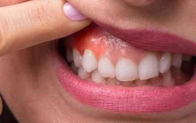 Blog 10 Gum Disease Treatment Near Me: Restore Your Oral Health Today