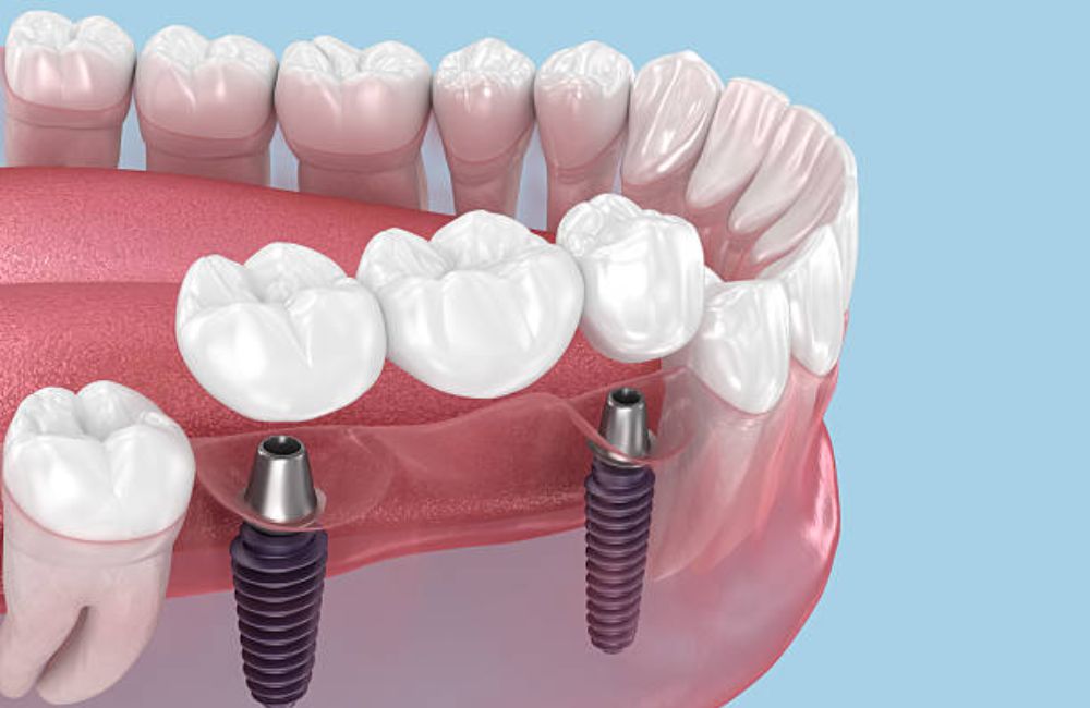 Agoka Dental Services in Tampa