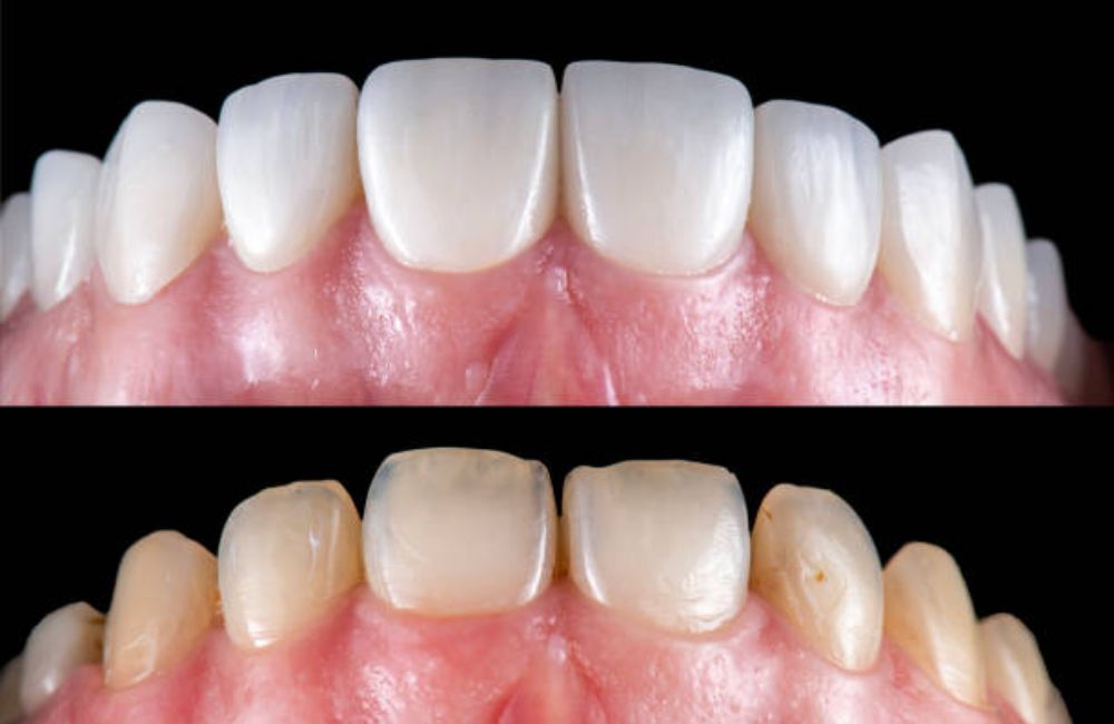 Agoka Dental Services in Tampa