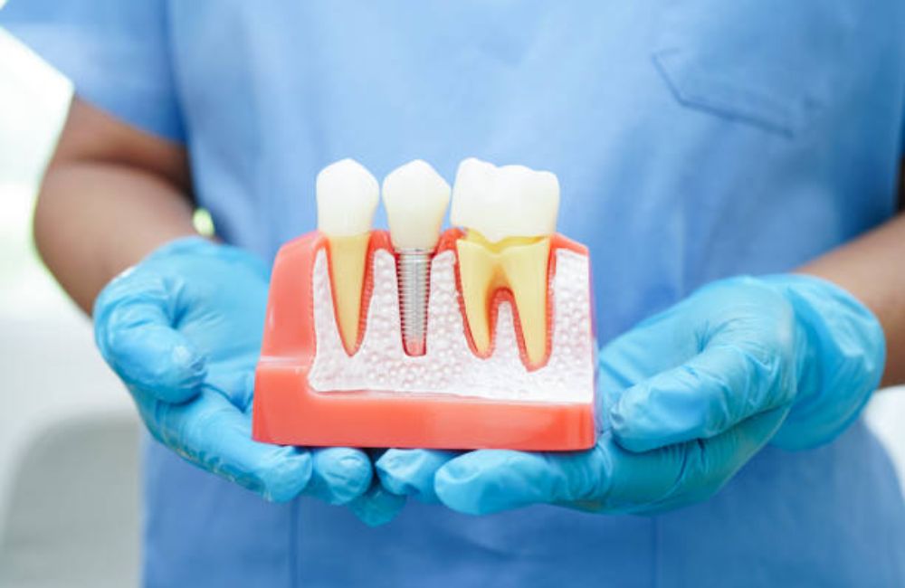 Agoka Dental Services in Tampa