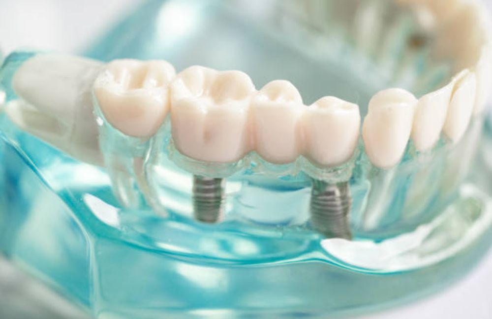 Agoka Dental Services in Tampa