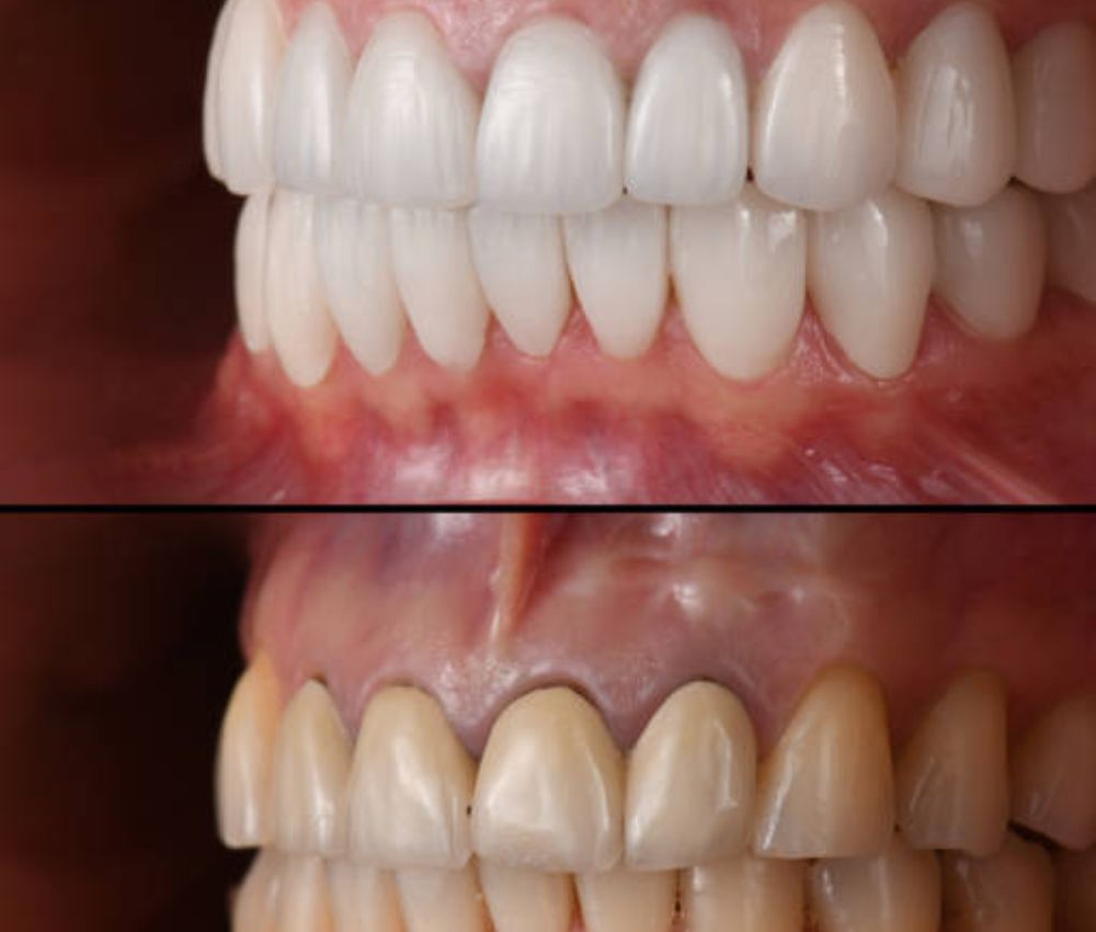 Agoka Dental Services in Tampa