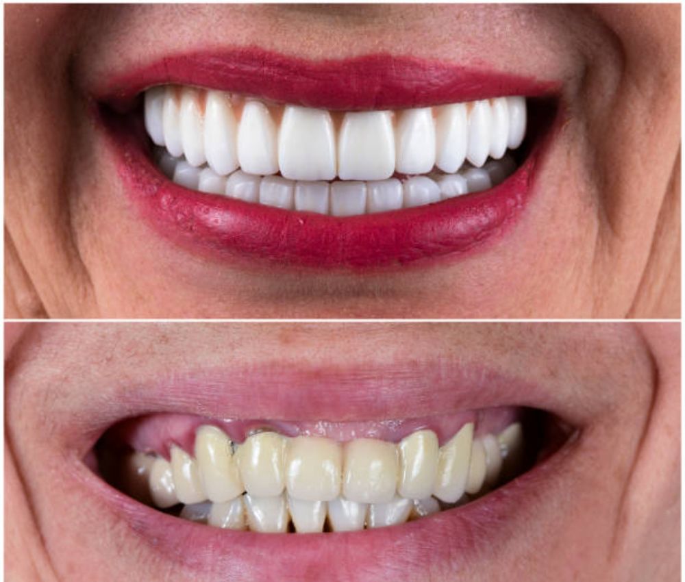 Agoka Dental Services in Tampa