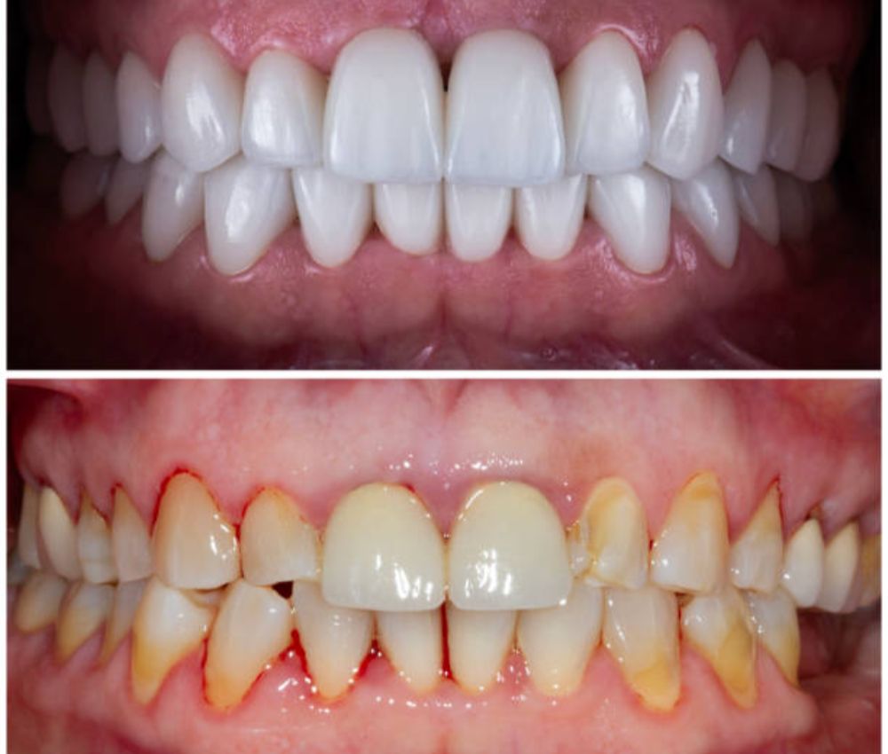 Agoka Dental Services in Tampa