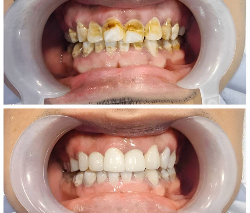 Agoka Dental Services in Tampa