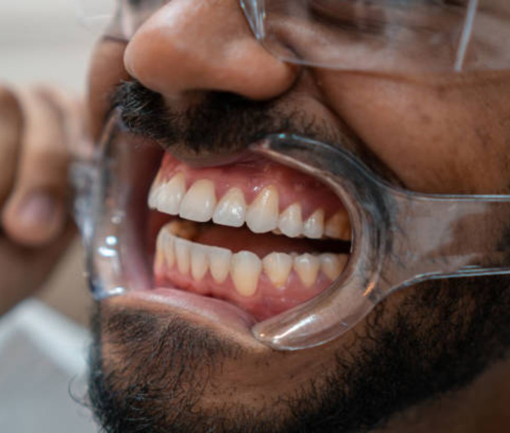 Agoka Dental Services in Tampa