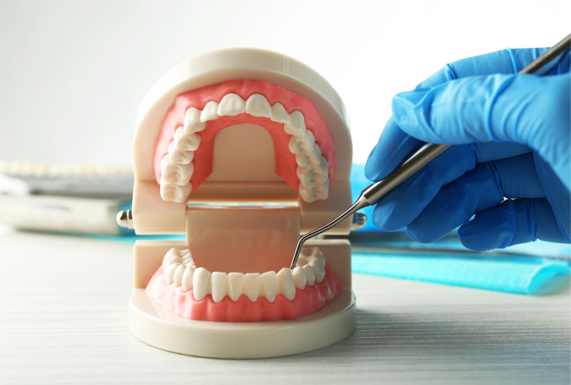 Professional Teeth Whitening In Tampa FL