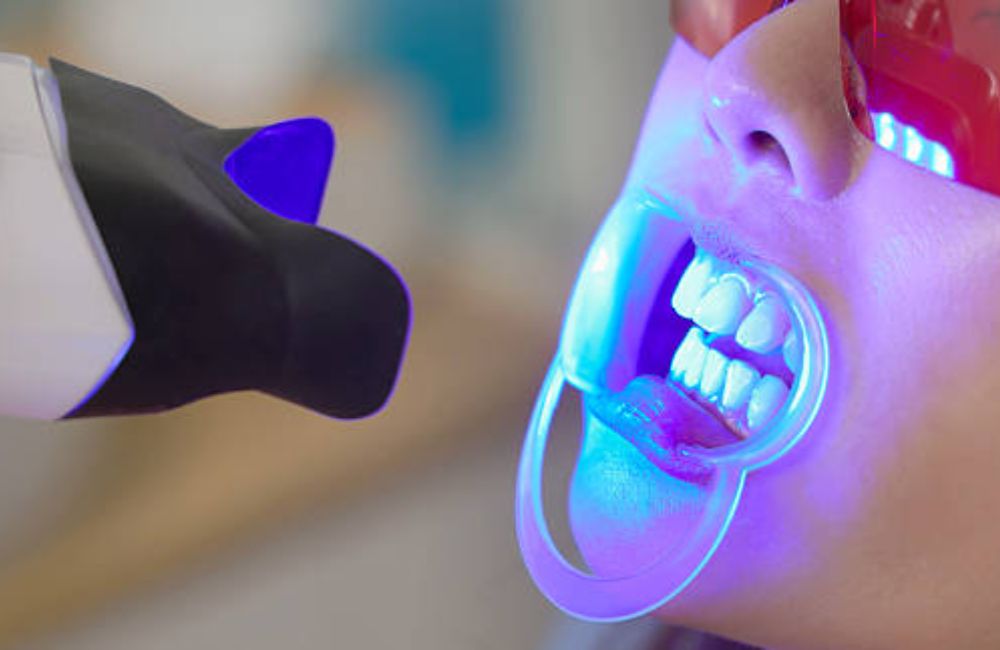 Agoka Dental Services in Tampa