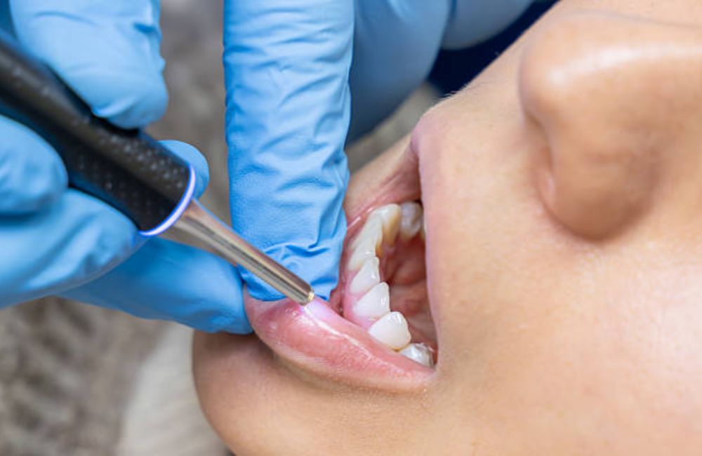 Agoka Dental Services in Tampa