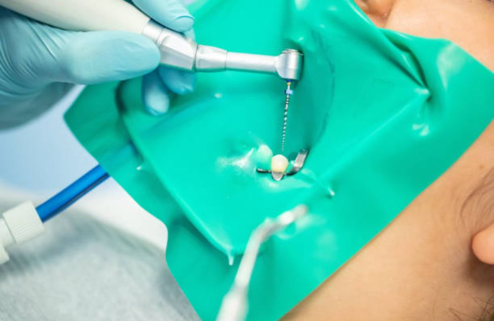 Agoka Dental Services in Tampa