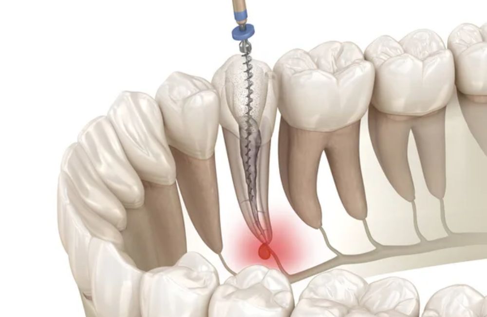 Agoka Dental Services in Tampa