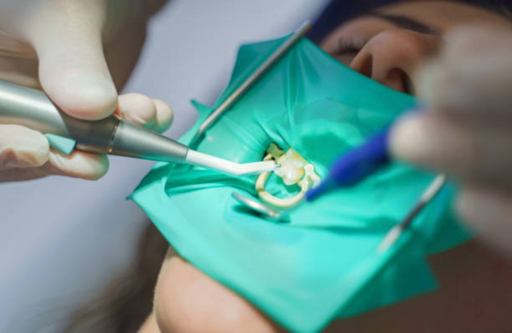 Agoka Dental Services in Tampa