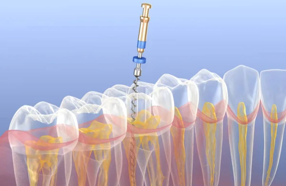 Agoka Dental Services in Tampa