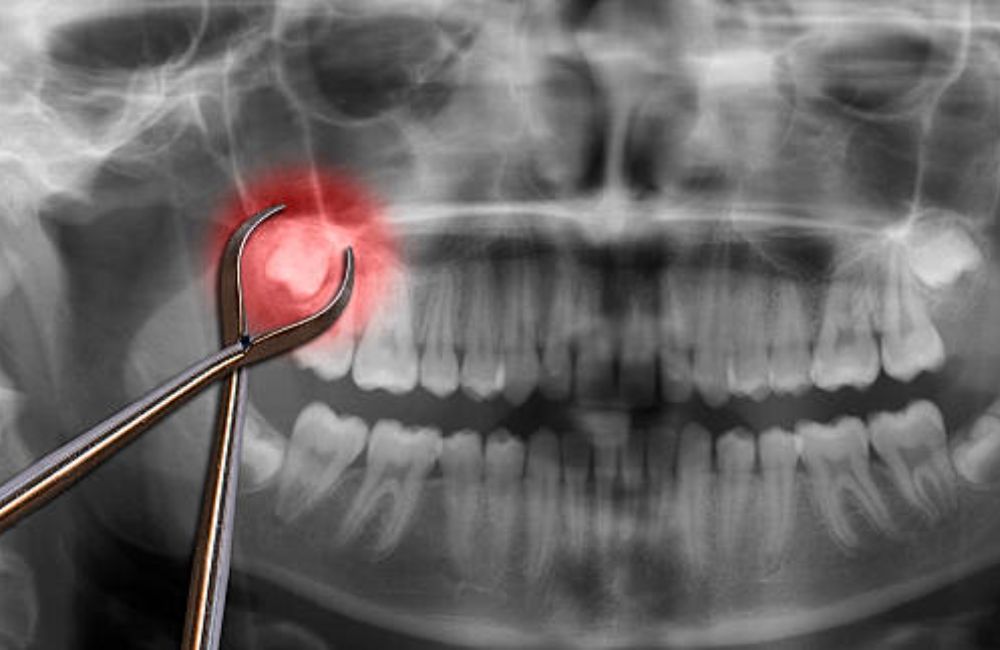 Agoka Dental Services in Tampa