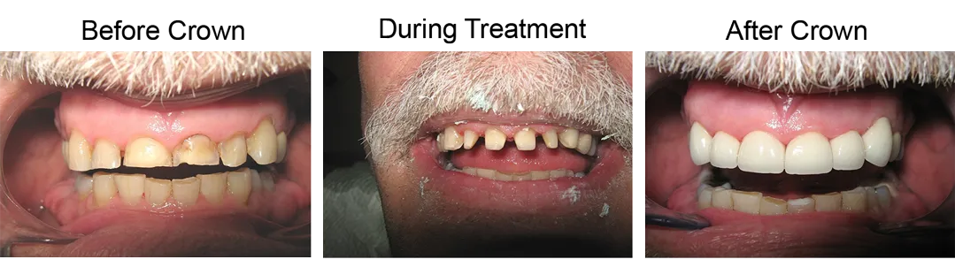 Dr. Naresh A Kalra